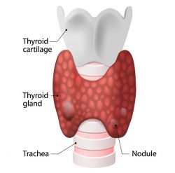 thyroid-problems